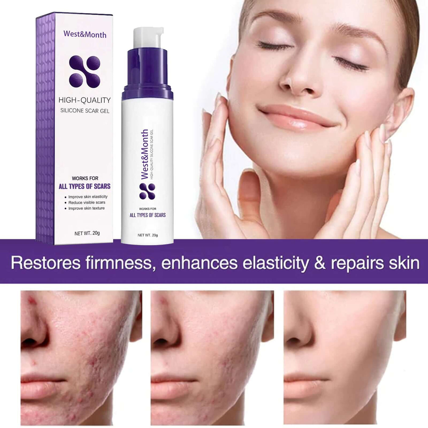 High-quality Silicone Scar Gel, Lighten Acne Mark Scar Repair Skin Smoothing Care Cream eprolo