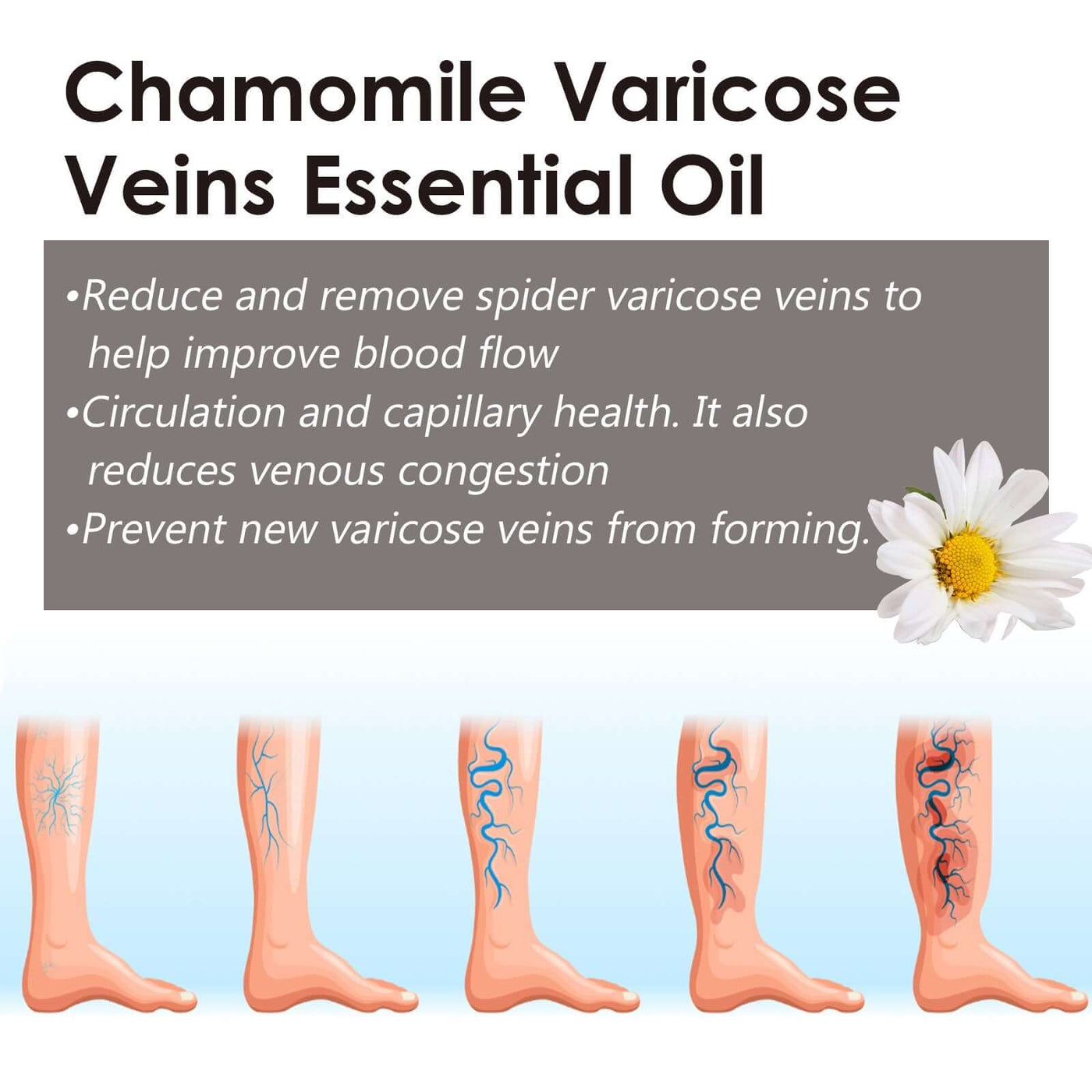 Chamomile Leg Essential Oil Protects Leg Skin And Relieves Leg Discomfort With Daily Massage Essential Oil eprolo