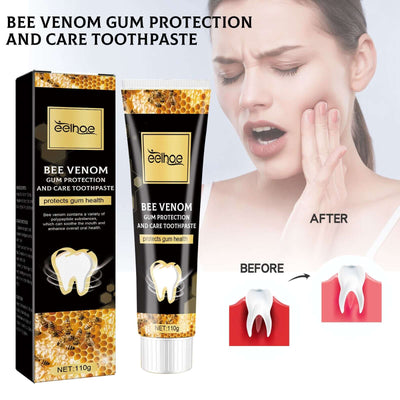 Bee Venom Gingival Toothpaste, Cleaning Stains Breath Fresh Whitening Toothpaste eprolo