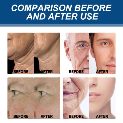 Collagen Wrinkle Remover Cream for Men, Anti Aging Fade Fine Lines Tightening Hydrating Cream eprolo