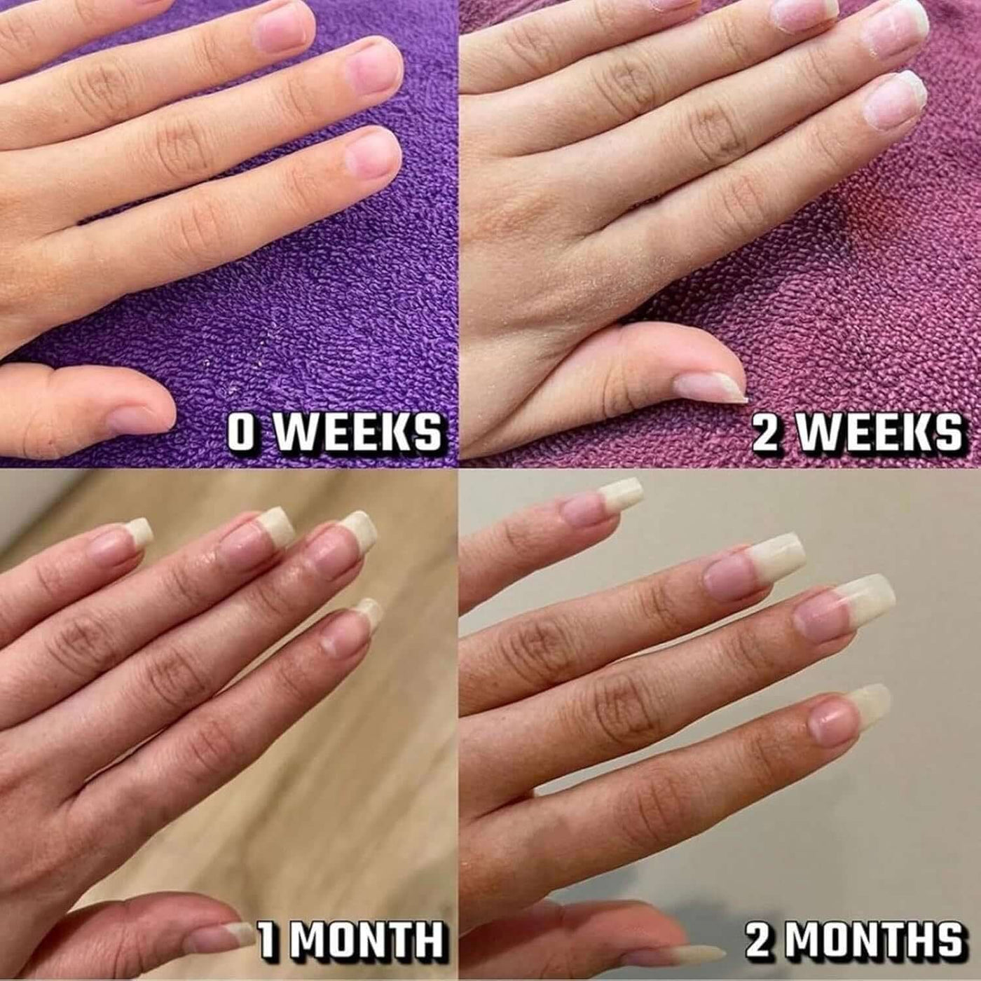 Vitality Nail Growth Oil Enhances Strength And Moisture eprolo