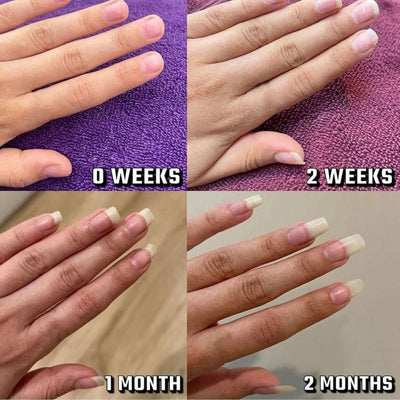 Vitality Nail Growth Oil Enhances Strength And Moisture eprolo