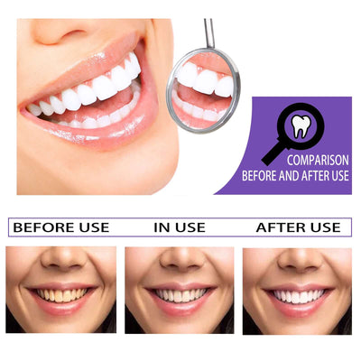 Teeth Whitening Toothpaste, Removing Teeth Stains And Odors Oral Care Brightening And Whitening Teeth Toothpaste eprolo