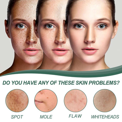 Herbal Natural Spot & Mole Cream, Blemishes Hydrating Whitening Brightening Cream eprolo