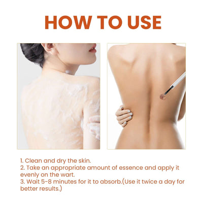 Anti-wart Essence, Anti Warts Fade Moles Corns Smoothing Skin Care Essence eprolo