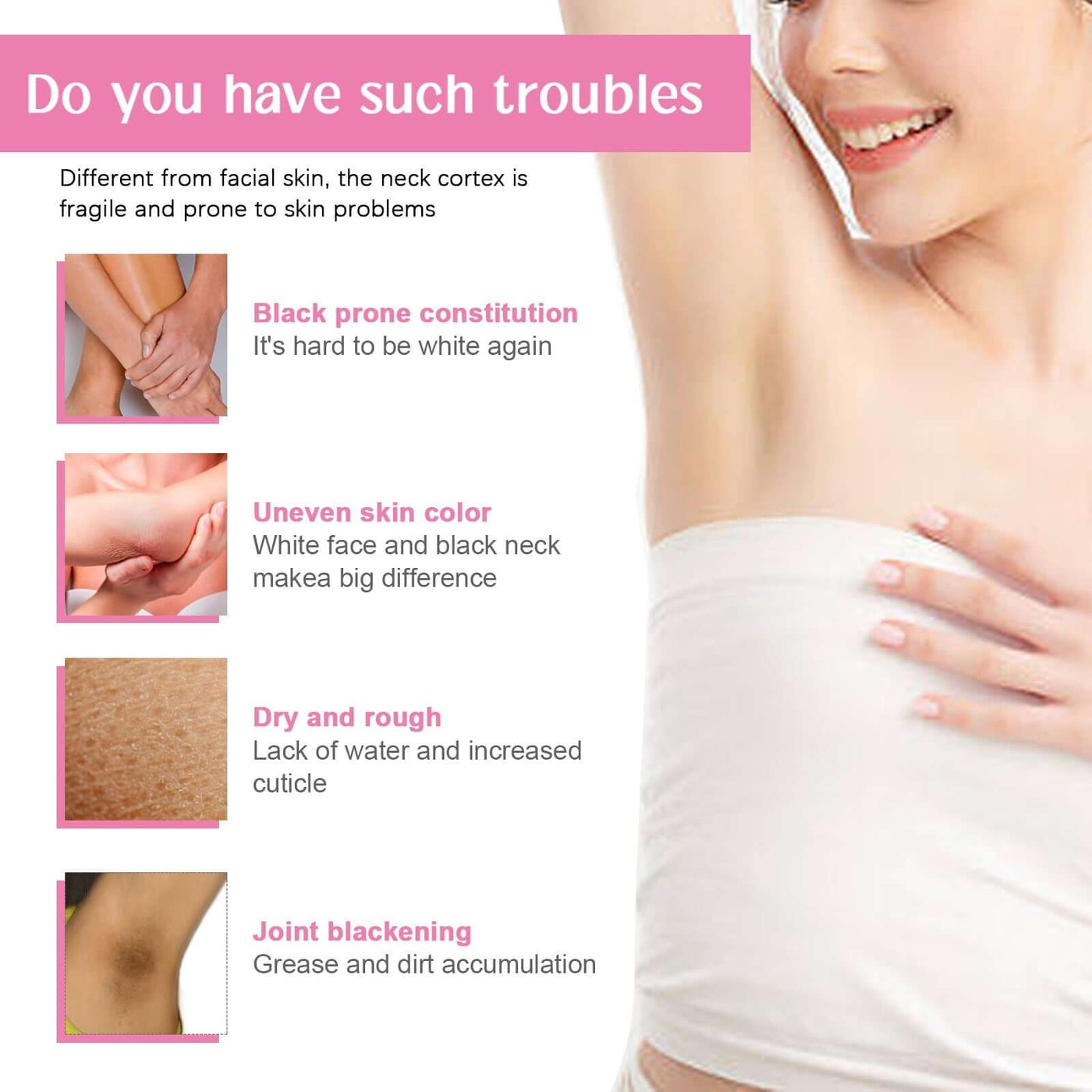 Underarm Whitening Essence Cream, Repair Acanthoderma Nigricans Tender And Smooth Skin Moisturizing Whitening Cream eprolo