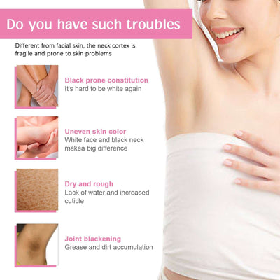 Underarm Whitening Essence Cream, Repair Acanthoderma Nigricans Tender And Smooth Skin Moisturizing Whitening Cream eprolo