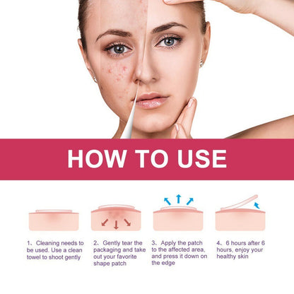 Wiieey Acne Patch Series Downplaying Acne Pockmarks Spots Cleansing Closed Mouth Multi-style Graphic Acne Patch eprolo