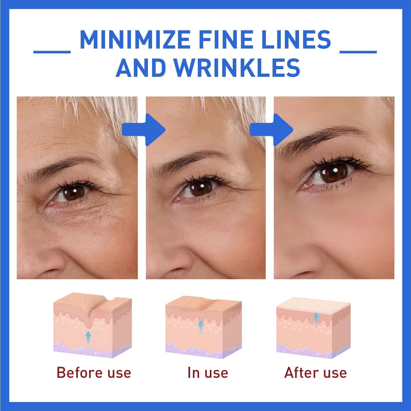 Collagen Facial Essence Reduces Fine Lines, Tightens Skin And Improves Dull Skin eprolo
