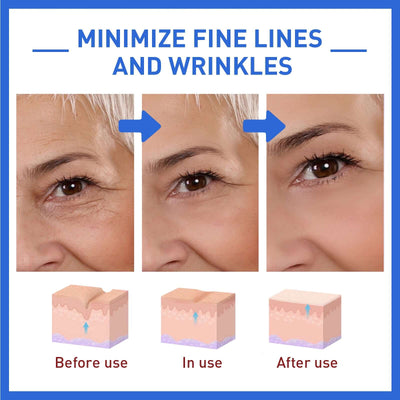 Collagen Facial Essence Reduces Fine Lines, Tightens Skin And Improves Dull Skin eprolo
