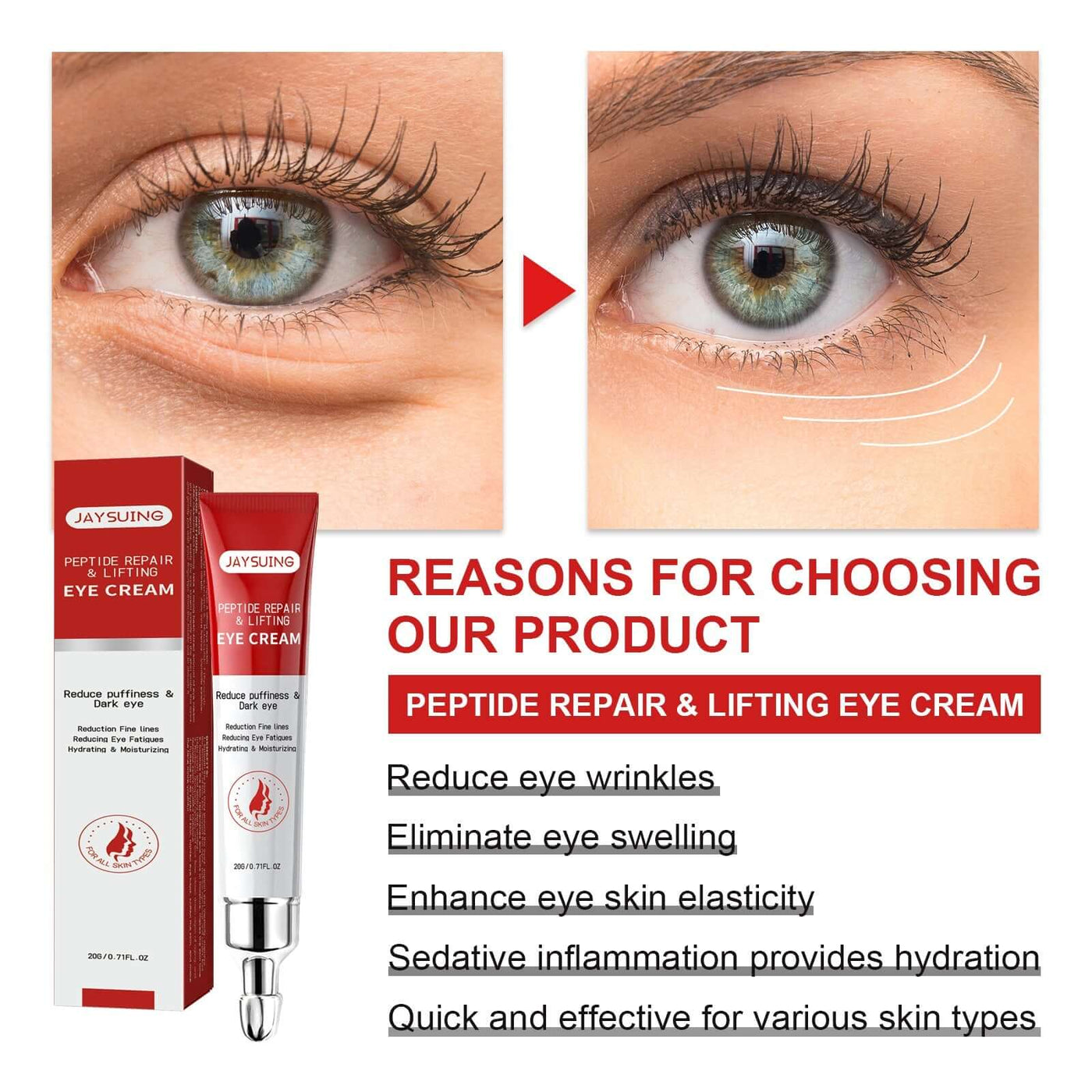 Nourishing And Moisturizing Eye Cream Keeps The Skin Around The Eyes Soft And Moisturized With A Gentle Daily Eye Cream eprolo