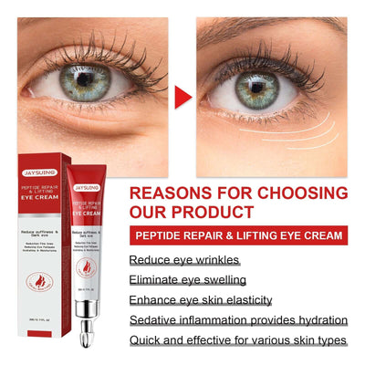Nourishing And Moisturizing Eye Cream Keeps The Skin Around The Eyes Soft And Moisturized With A Gentle Daily Eye Cream eprolo