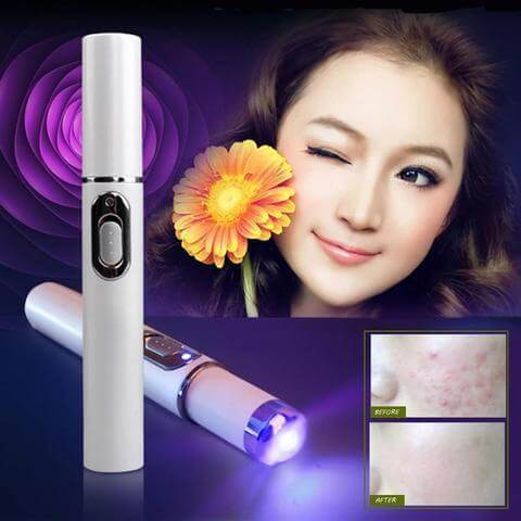 Blue light therapy acne laser pen shown with results on skin, promoting scar and wrinkle removal for skincare.