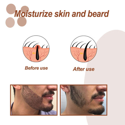 Beard Oil, Men's Beard Care Gloss Smooth Root Care Moisturizing Essence Oil eprolo
