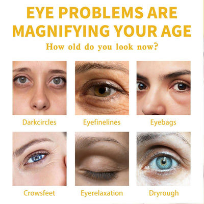 Vitamin E Eye Cream, Lightened Dark Circles Crow's Feet, Firmed And Moisturized Eye Cream eprolo