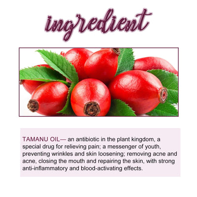 Tamanu Facial Oil, Relieves Acne Marks Fine Lines Moisturizes and Firms Skin Essential Oil eprolo