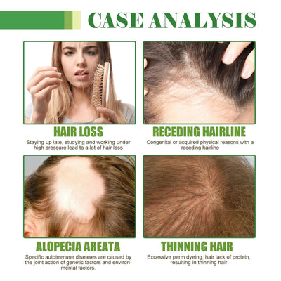Hair Care Oil, Repair Damage Improve Dry Hair Prevent Hair Loss And Smooth Essential Oil eprolo