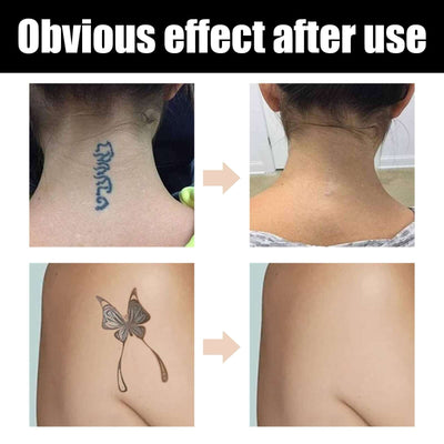 EELHOE Tattoo concealer waterproof brightening cover tattoo scar birthmark scar invisible two-color concealer eprolo