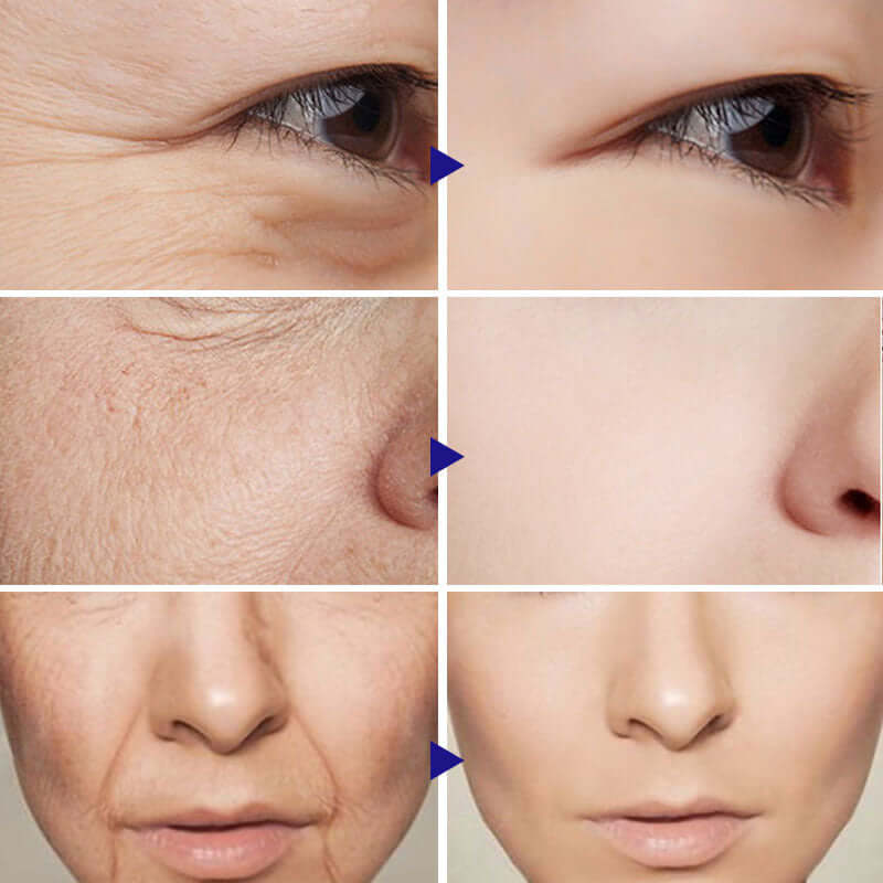 Vitamin C Serum Facial Serum Amazon eprolo