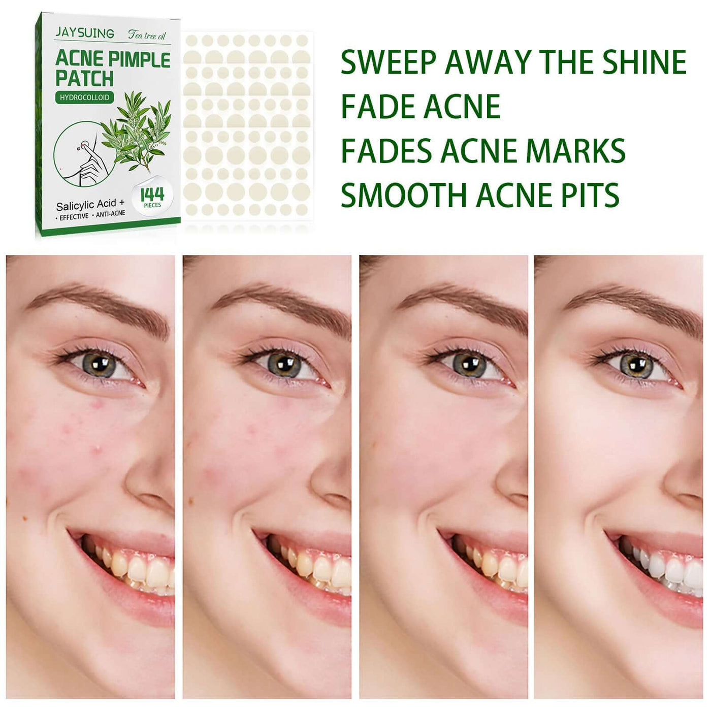 Waterproof Invisible Acne Patch Lighten Acne Acne Print Moisturizing Repair Clear Patch eprolo