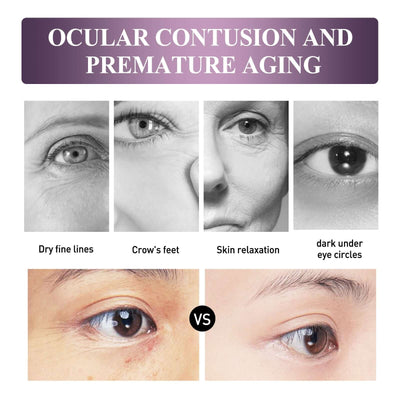 Electric Anti-Wrinkle Eye Cream Lifts, Strengthens, Moisturizes And Reduces Fine Lines, Bags And Dark Circles Under Eye Care eprolo