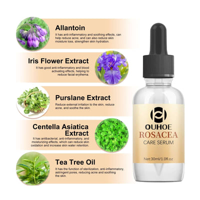 Erythematous Repair Essence, Repair Skin Lighten Facial Erythematous Moisturizing Essential Oil eprolo
