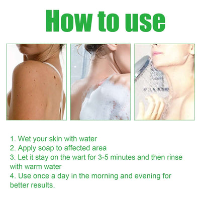Mole Remover Soap, Repair Meat Granules Corns And Dark Moles, Smooth Skin Anti-wart Cleansing Soap eprolo