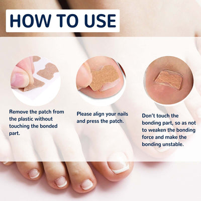 Nail Correction Patch, Nail Insert Correction And Repair Toe Manicure Nail Patch eprolo