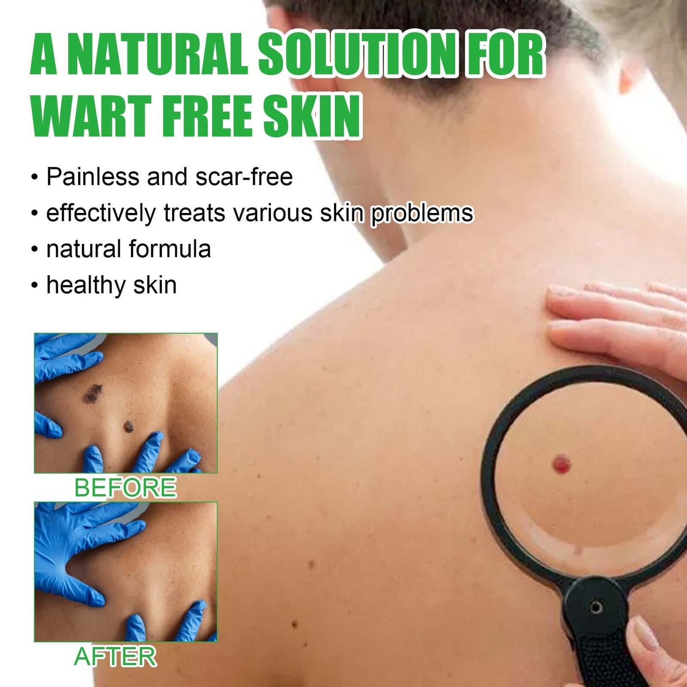Mole Remover Soap, Repair Meat Granules Corns And Dark Moles, Smooth Skin Anti-wart Cleansing Soap eprolo