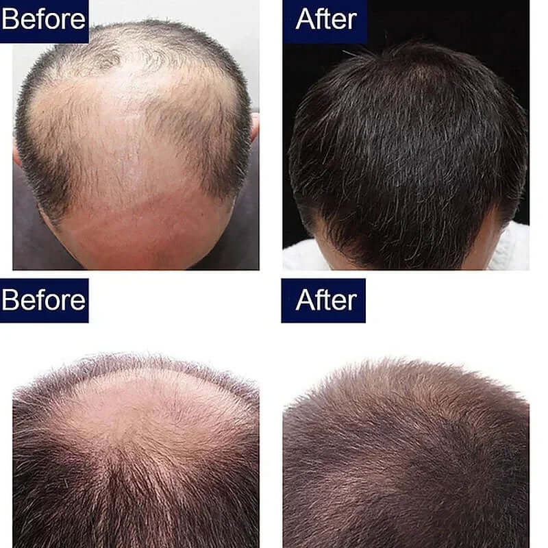 7 Day Fast Hair Growth Oil Ginger Growth Hair Treatment Anti Hair Loss Men Women Scalp Treatment Serum Products Beauty Product eprolo