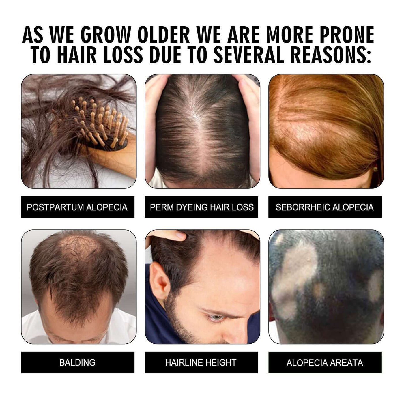 Hair Conditioning Essence, Repair Dull Smooth Hair And Scalp Massage Treatment Hair Conditioning Essence eprolo