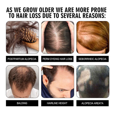 Hair Conditioning Essence, Repair Dull Smooth Hair And Scalp Massage Treatment Hair Conditioning Essence eprolo