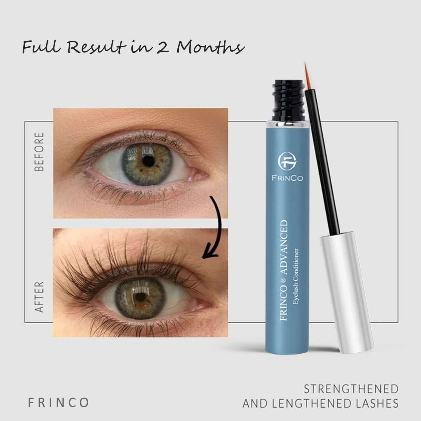 Advanced Eyelash Enhancing Serum, Eyelash Conditioner For Promoting Fuller & Thicker Looking Lashes, Eyelash And Brow Growth Serum, 5ml eprolo
