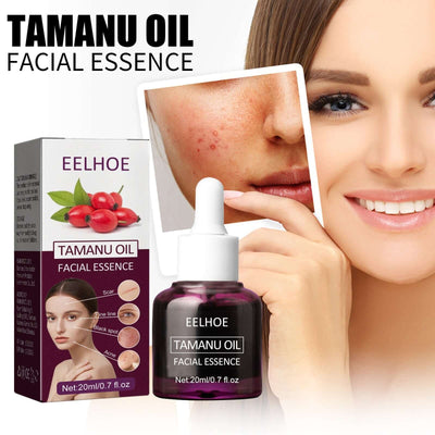 Tamanu Facial Oil, Relieves Acne Marks Fine Lines Moisturizes and Firms Skin Essential Oil eprolo