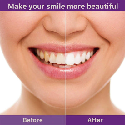 Tooth Cleaning Mousse, Anti-Decay Clean Teeth Tartar Breath Fresh Whitening Teeth Toothpaste eprolo