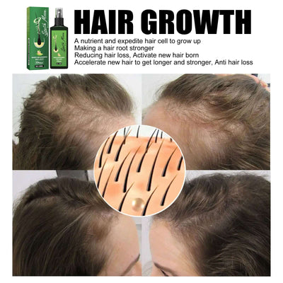 Hair Care Spray Nourishing And Nourishing Hair Massage Repair Hair And Scalp Care Solution eprolo