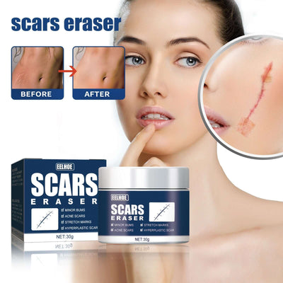 Scar Balm, Surgery Scar Repair Cold Compress Scar Skin Scar Gel Balm eprolo