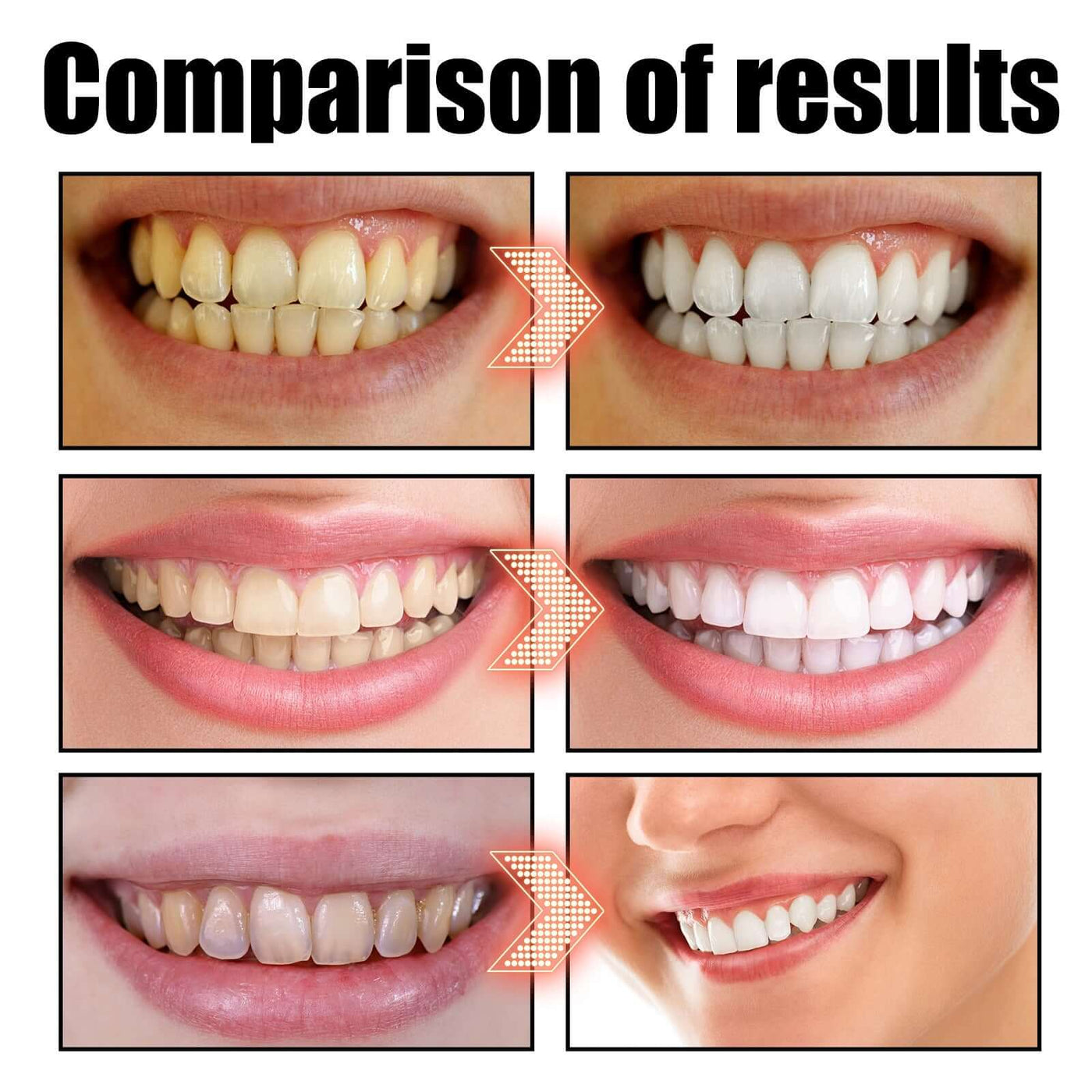 EELHOE   Oral Coconut Oil Mouthwash Removes Stains Beautifies Teeth Freshens Breath Cleans Mouth And Protects Gums eprolo