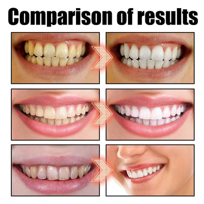 EELHOE   Oral Coconut Oil Mouthwash Removes Stains Beautifies Teeth Freshens Breath Cleans Mouth And Protects Gums eprolo