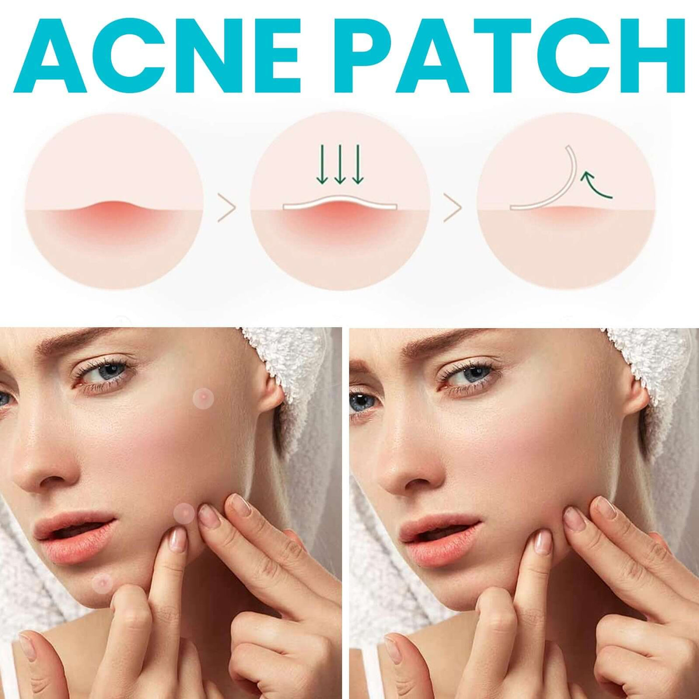 Acne Patch, Repair Facial Acne Invisible Concealer Hydrocolloid Patch eprolo