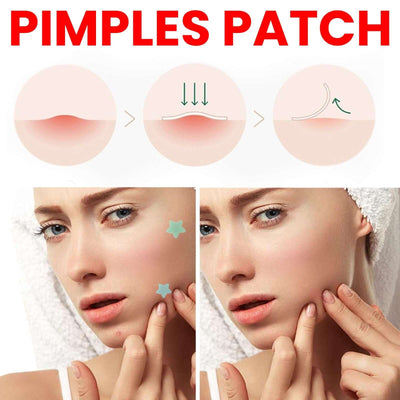 JaysuingRepair Acne Patch Facial Skin Care Fade Blemishes Pimple Marks Closed Acne Blemishes Cover Acne Pimple Repair Patch eprolo
