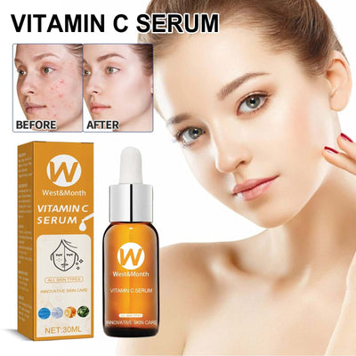 Facial Treatment Essence, Lighten Facial Acne Mark Oil Control Firming Skin Essence eprolo
