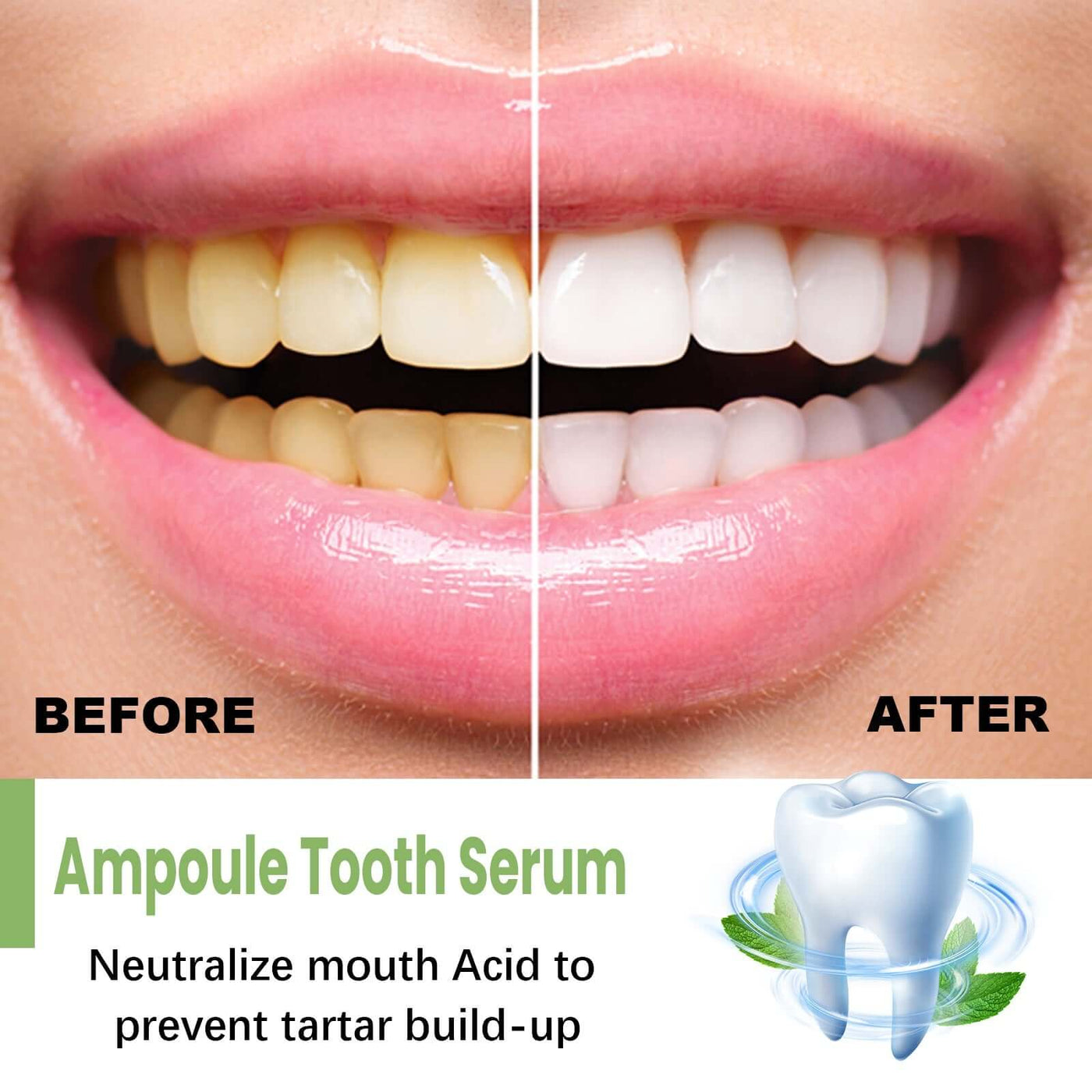 Teeth Whitening Serum To Remove Stains, Bad Breath, Whitening Teeth And Whitening Teeth eprolo