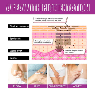 Skin Firming Cream, Brightening Skin Melanin Removal Brightening Skin Moisturizing Cream eprolo