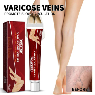 Venous Massage Varicose Cream, Relieves Bulging Leg Blood Vessels And Swollen Leg Earthworm Venous Massage Cream eprolo