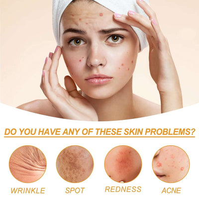 Facial Treatment Essence, Lighten Facial Acne Mark Oil Control Firming Skin Essence eprolo