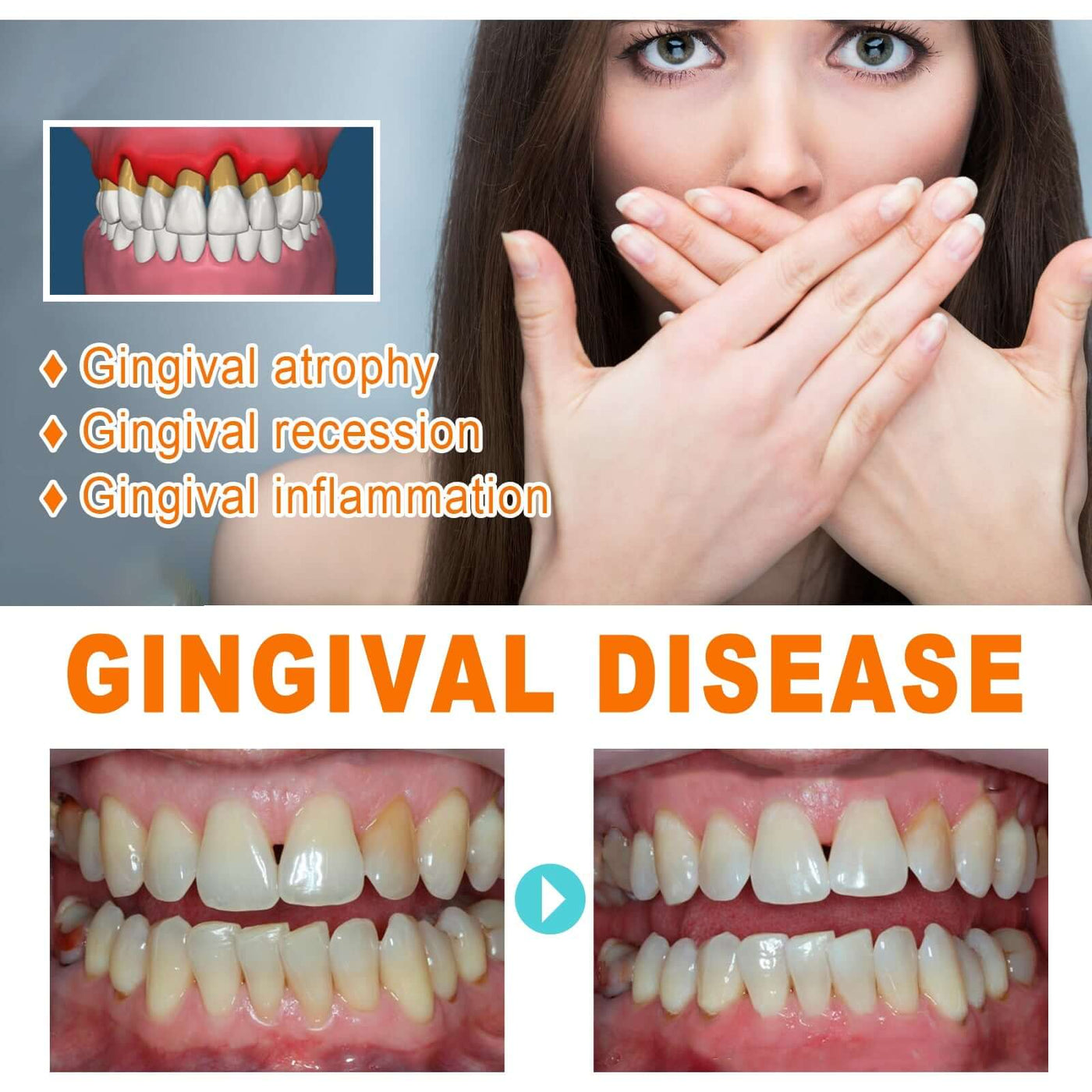 Tooth Repair Essence, Cleaning Teeth Stains Tartar Care Gums Oral Care Essence eprolo