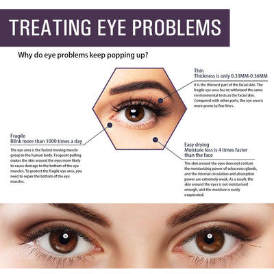 Electric Anti-Wrinkle Eye Cream Lifts, Strengthens, Moisturizes And Reduces Fine Lines, Bags And Dark Circles Under Eye Care eprolo