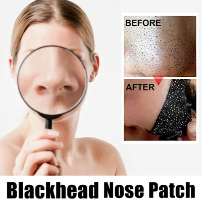 Black Pig Nose Patch, Bamboo Charcoal Remove Blackhead Acne Tear Nose Mask Patch eprolo