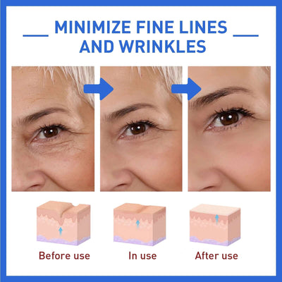 Anti-Aging Collagen Serum with Nicotinamide, Vitamin C, Hyaluronic Acid - Reduce Dark Spots, Cleanse & Tighten Skin eprolo